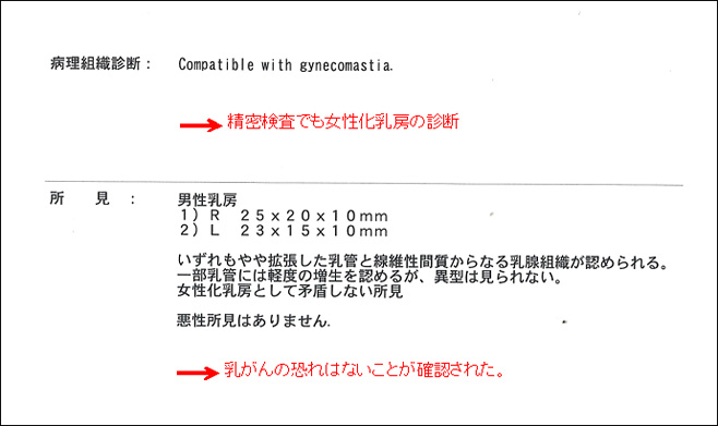 女性化乳房修正術症例№13精密検査の結果