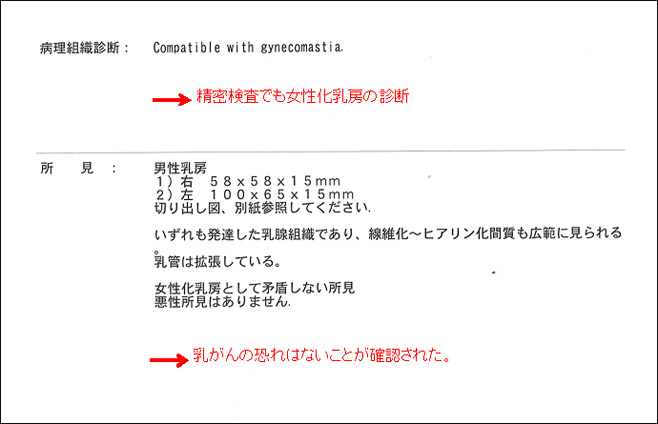女性化乳房修正術症例№14精密検査の結果