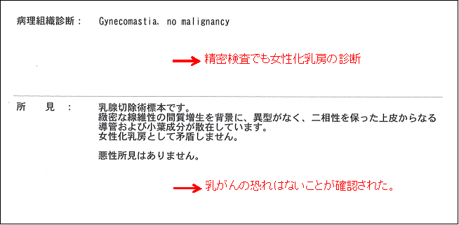 女性化乳房修正術症例№08精密検査の結果