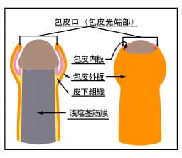 包茎の包皮図