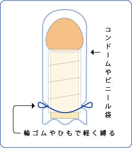 屈曲ペニス湾曲ペニスの手術後の包帯交換